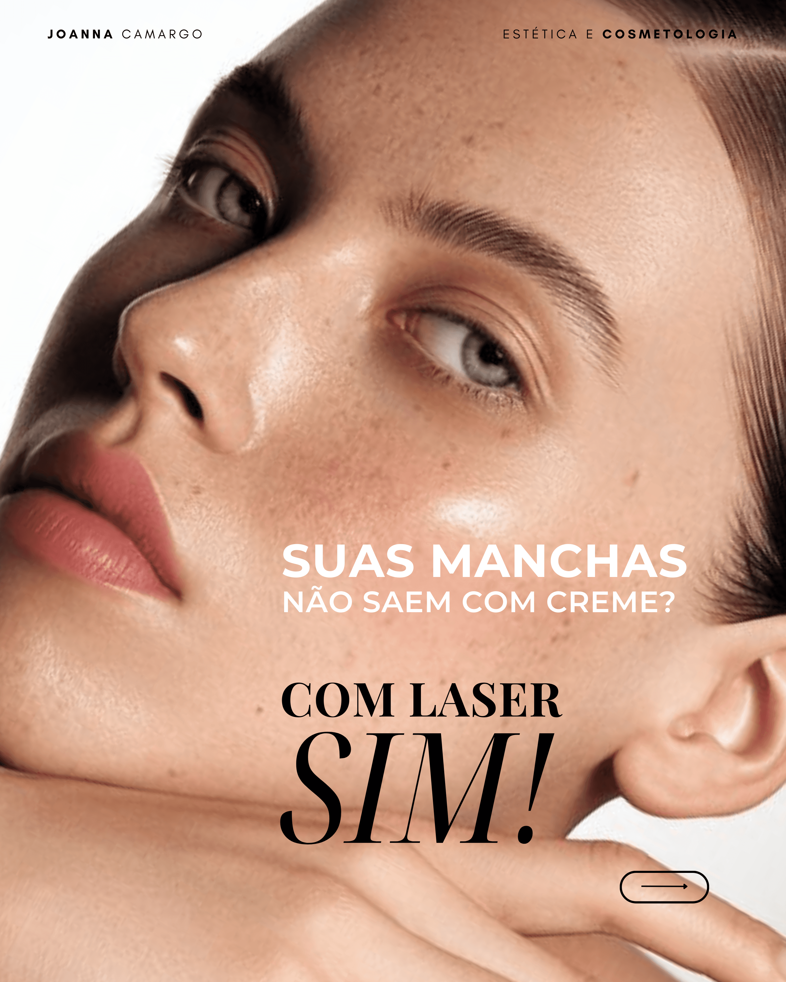 Laser - Joana Camargo